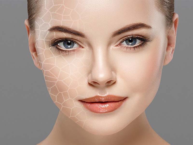 کربوکسی تراپی